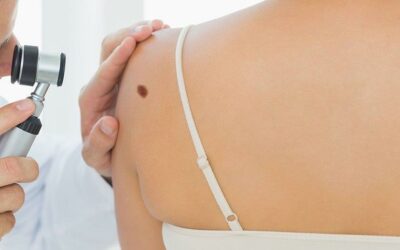 Skin Cancer, il melanoma fa meno paura: “Dalla rivoluzione nelle terapie al rapporto dermatologia-arte”. Confronto esperti internazionali a Trapani